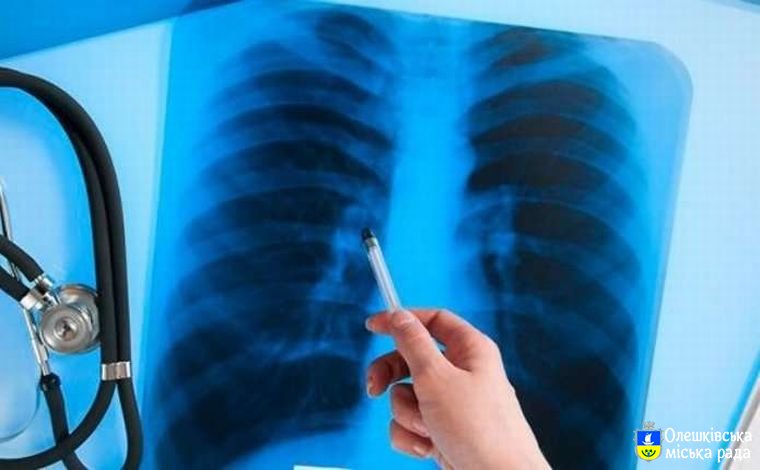 В Олешках депутати  виділили кошти на вакцинацію дітей