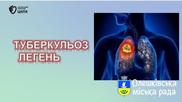 Профілактика туберкульозу: важлива інформація для громади